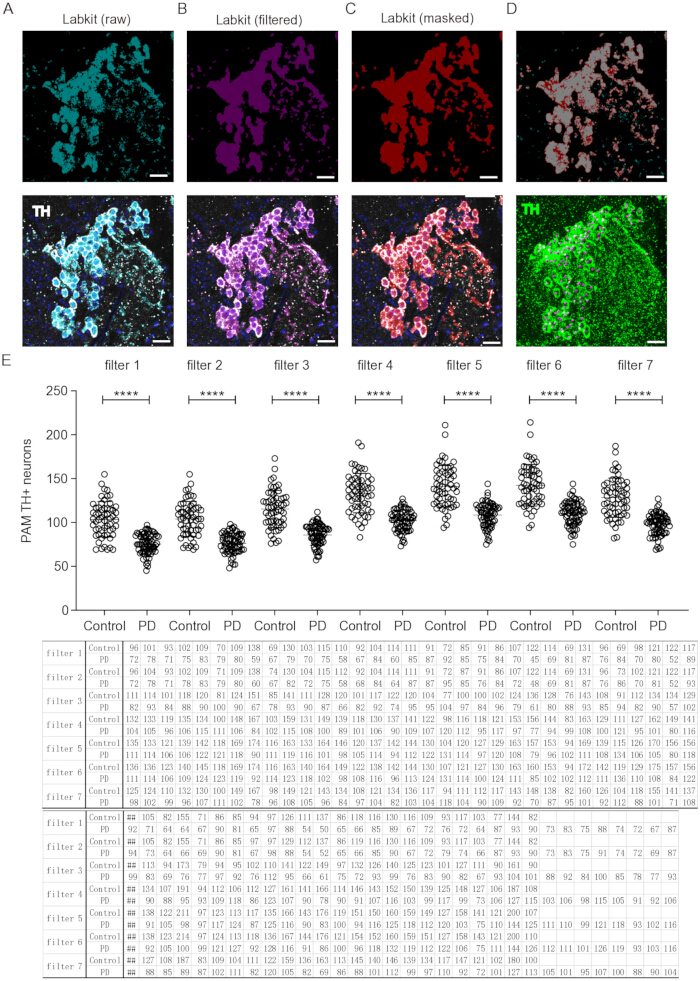 Labkit analysis: cell imaging, filter application, neuron count graph, data table, neuroscience study.