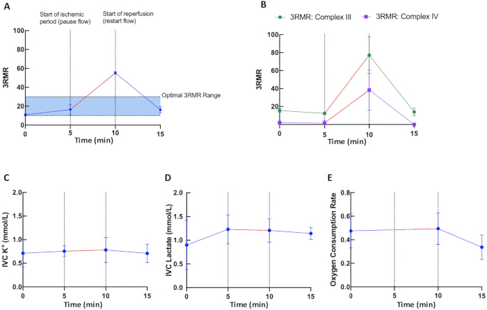Graph showing 3RMR over time; ischemic and reperfusion points; analyzes IVK, lactate, oxygen rates.