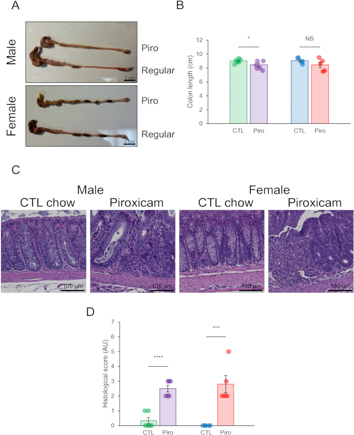 figure-results-2 Colorectal study; diagrams of mouse colon lengths, histology, data graphs on Piroxicam effects.