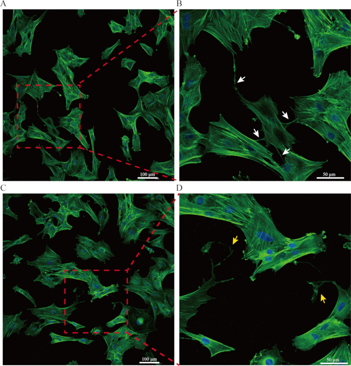 figure-protocol-1 Fluorescence microscopy of cell cytoskeleton, actin fibers highlighted; high-resolution imaging.