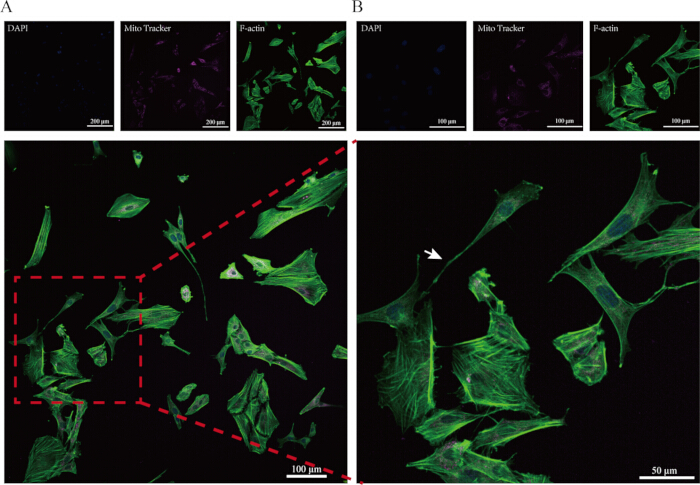 figure-protocol-2 Fluorescence microscopy diagram displaying DAPI, MitoTracker, and F-actin in cell structure analysis.
