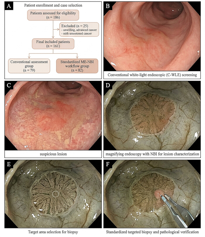 Colorectal screening workflow; endoscopy; biopsy procedure; lesion analysis; medical imaging.