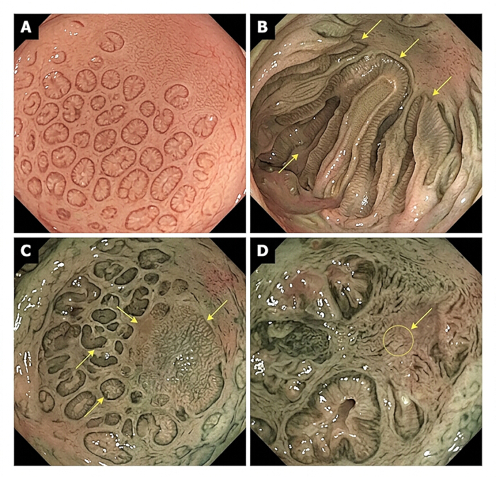 Endoscopic view of gastric mucosa showing different morphology patterns for medical analysis.