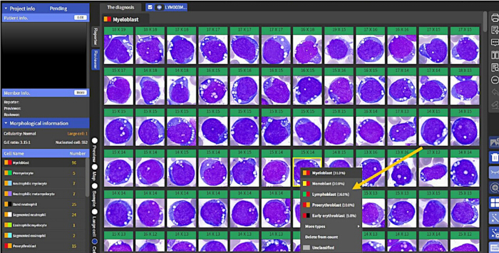 figure-results-3 Cell morphology analysis, microscopic image grid, hematopoietic cell classification, diagnostic software.