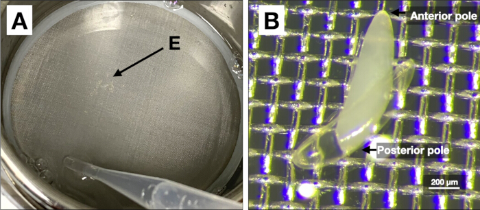 Static equilibrium illustrated; experimental setup with pipette; microscope image of examined specimen.