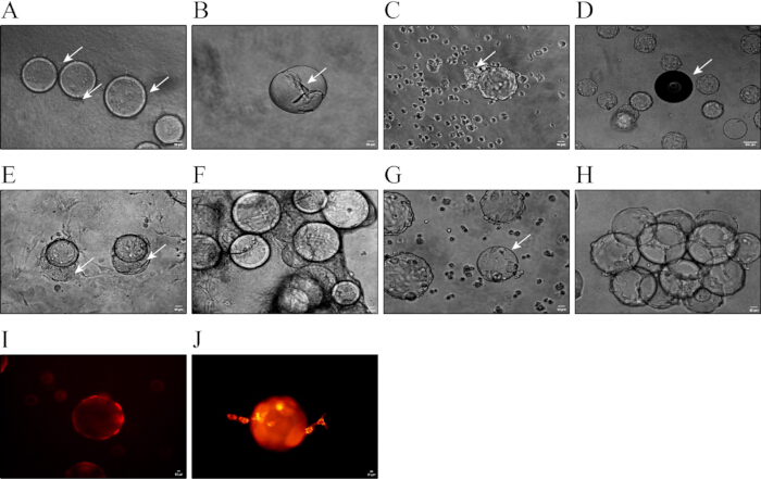 Cellular structures under phase-contrast and fluorescence microscopy; arrows indicate specific features.