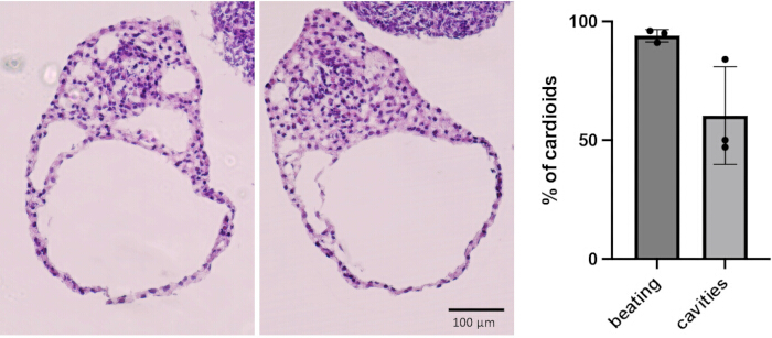 figure-results-2 Cardioid histology with graph; analyzing cavity formation, beating percentage; scale bar 100 μm.