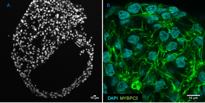 figure-results-3 Fluorescence microscopy; panel A: DAPI-stained nuclei, panel B: MYBPC3 green fluorescence confocal.