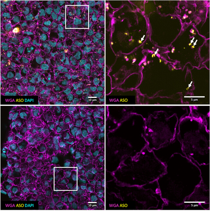 figure-results-4 Fluorescence microscopy image; cell labeling with WGA, ASO, DAPI; cellular structure analysis.