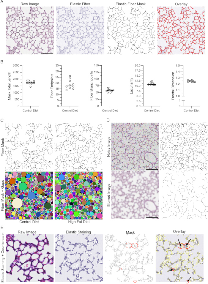 figure-results-1 Elastic fiber analysis, elastic staining, fiber mask, overlay diagram, diet comparison, microscopy results.