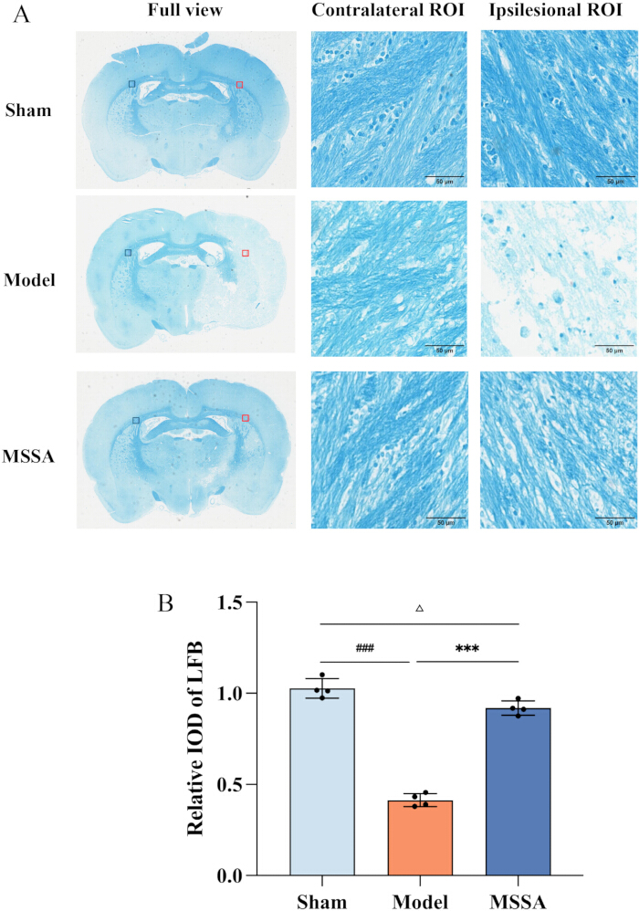 figure-results-4 Histological analysis comparing Sham, Model, MSSA with Luxol Fast Blue staining; bar graph results.
