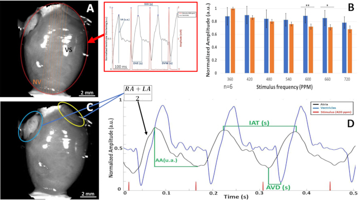 figure-results-3 Cardiac imaging and graph analysis; vs/RA+LA; amplitude chart; normalized results; experimental setup.