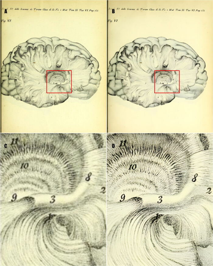 figure-results-4 Brain anatomy diagram highlighting hippocampus structure, comparison details, educational use.