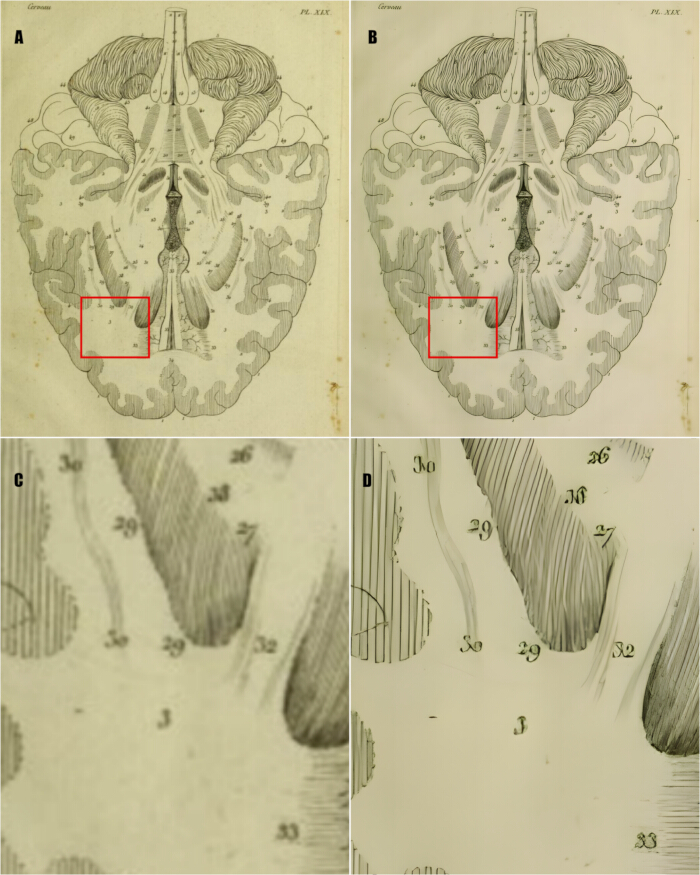 figure-results-5 Human brain anatomy diagram; cerebellum sections; detailed labeled illustrations.