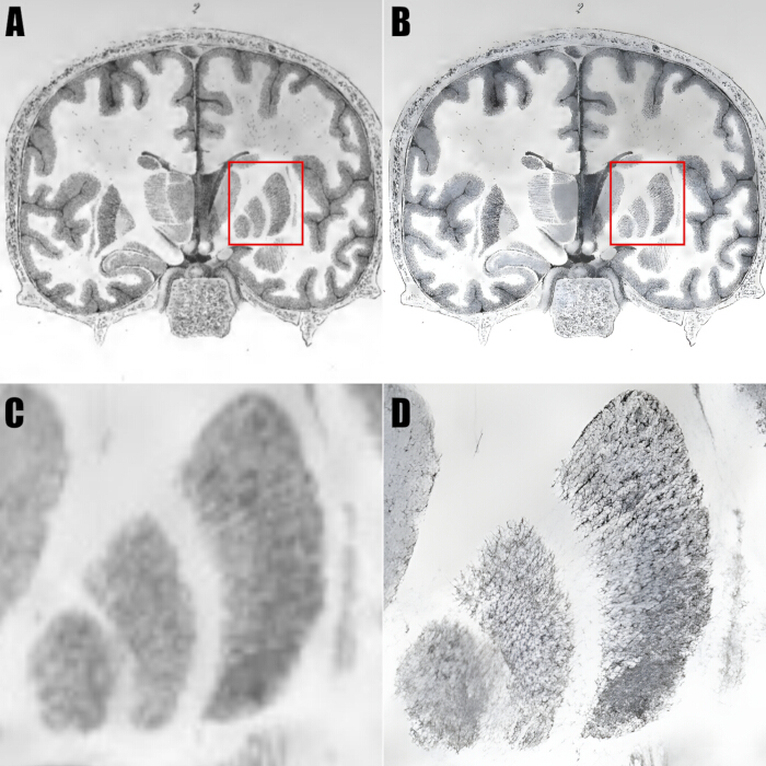 figure-results-6 Brain coronal section diagram; microstructure analysis; neuronal alignment; histology comparison.